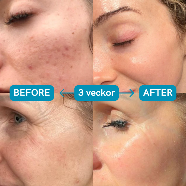 Sensitive-Mild Retinol oil