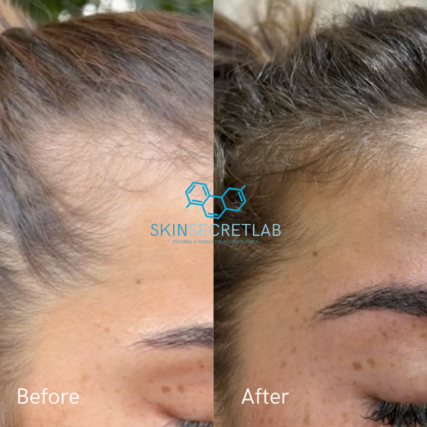 Anti-Hair Fall Root Repair Serum