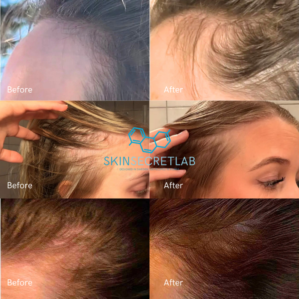 Anti-Hair Fall Root Repair Serum
